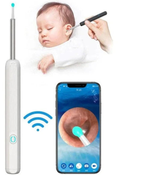 Modern earwax cleaning kit for at-home use