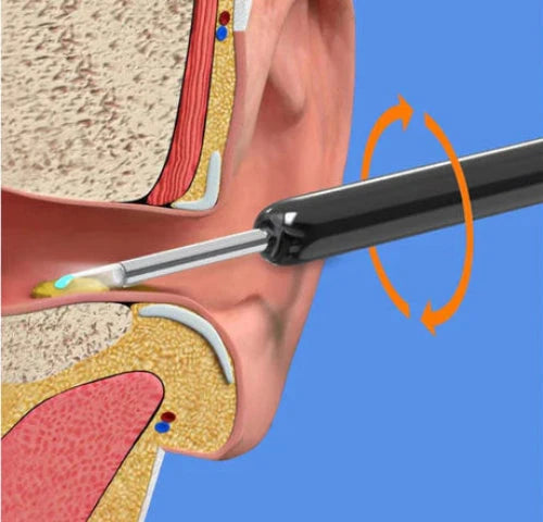 USB rechargeable ear cleaner with real-time view