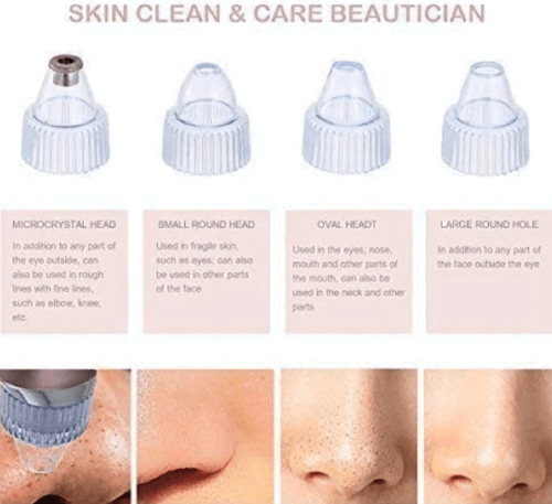 Before and after results using pore cleaner on nose