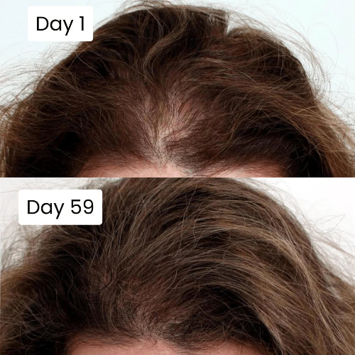 Before and after hair growth results using Scalpy Hair Ampoule
