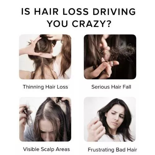 Meme about hair loss issues with text and images of hair thinning, falling out, visible scalp areas, and frustrating bad hair.