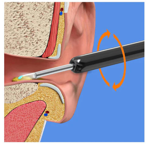 Smart Earwax Remover Kit with HD Camera showing tool inserted into ear canal with LED light and rotation arrows for safe cleaning.