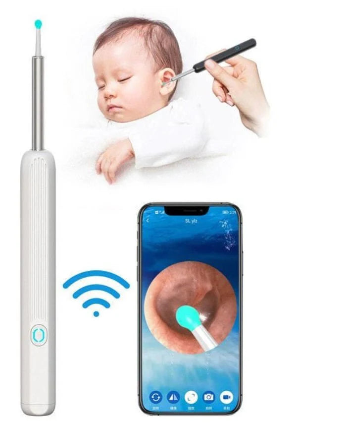 Smart Earwax Remover Kit with HD Camera showing wireless connection to smartphone and safe use on a baby. Ideal for precise ear cleaning at home.