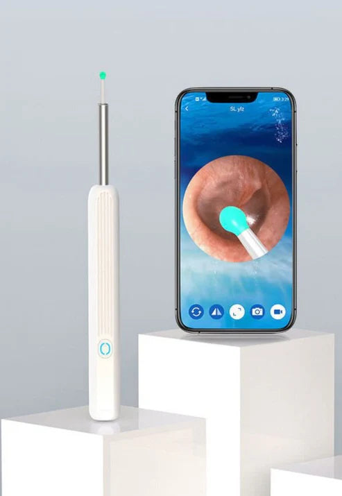 Smart Earwax Remover Kit with HD Camera showing real-time ear canal view on smartphone screen. Ideal for precise ear cleaning at home.
