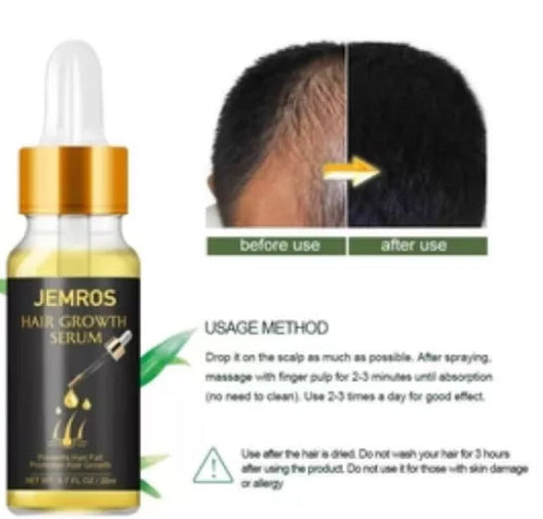 Hair growth serum bottle with 'JEMROS' branding, showing before and after effects on hair.