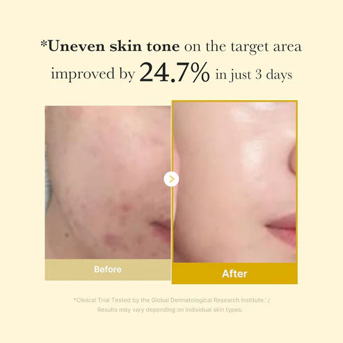Kojic Acid Turmeric Night Wrapping Mask - Brighten Skin Overnight with visible results; before and after comparison shows reduced dark spots and improved skin tone in 3 days.