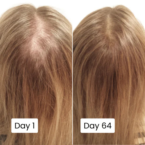 Before and after comparison of hair growth over 63 days on a person's head.