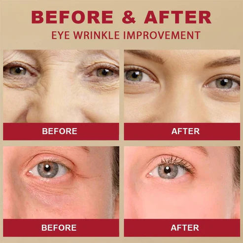 Before and after comparison of eye wrinkles on a beige background
